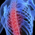Thumbnail for blog OSTEOPOROSE: DOENÇA SILENCIOSA